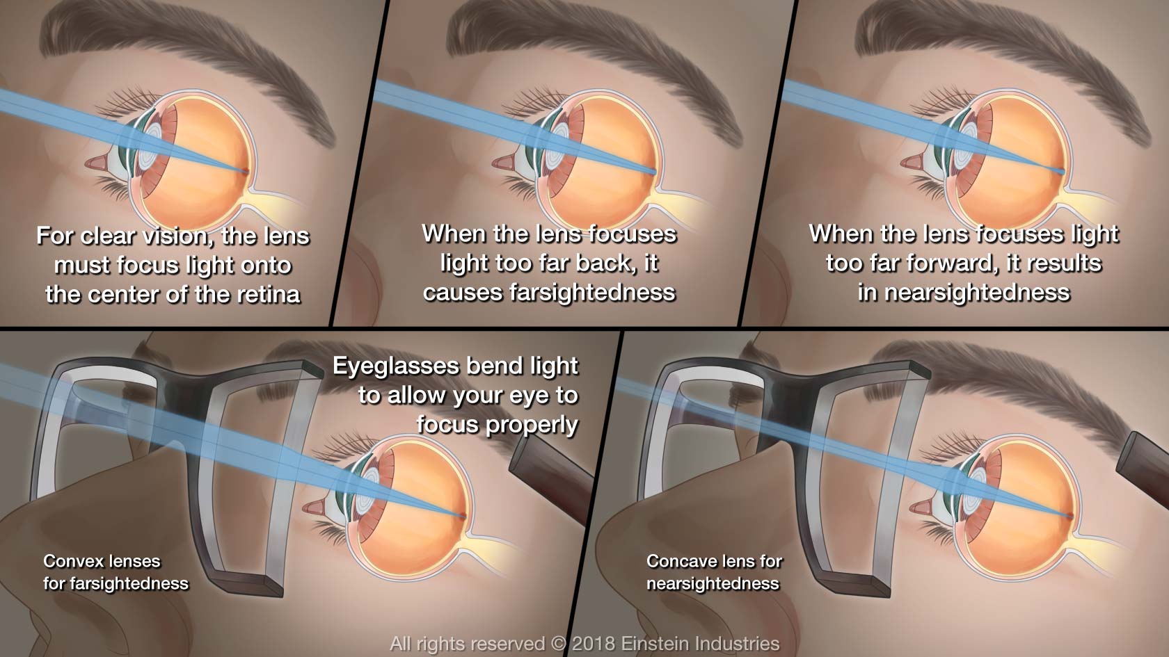 How Eye Glasses Correct Vision